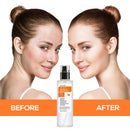 Eine Vorher-Nachher-Gegenüberstellung einer Frau, die die Verbesserung ihres Hautbildes nach der Anwendung von Harmonify Advanced Snail Mucin mit Aloe Vera zeigt.