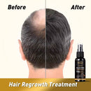 Eine Vorher-Nachher-Darstellung der Kopfhaut eines Mannes, die verbesserte Haardichte und reduzierten Haarausfall nach der Anwendung des Eco Finest Organic Black Rice Water Sprays als Haarwuchsbehandlung zeigt.