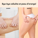 Ein Vorher-Nachher-Bild, das links ("avant") eine Nahaufnahme eines Oberschenkels mit sichtbarer Cellulite und rechts ("après") einen glatten, straffen Oberschenkel und Po zeigt.